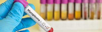 Micoplasmi nel pollame. Protocollo di campionamento e consegna al laboratorio per l’isolamento colturale Micoplasmi nel pollame. Protocollo di campionamento e consegna al laboratorio per l'isolamento colturale