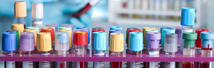 Consegna campioni H24 presso le sedi IZSVe di Padova e Treviso Consegna campioni H24 presso le sedi IZSVe di Padova e Treviso