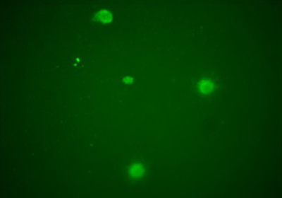 Micoplasmi