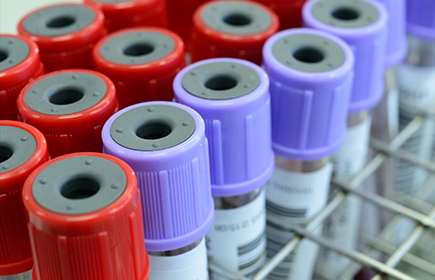 gestione del campione per esami diagnostici nei pet birds