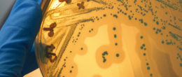 Permalink to: Corso ECM / Il challenge test: strumento operativo per valutare Listeria monocytogenes alla luce del Reg. CE 2073/2005 Corso ECM / Il challenge test: strumento operativo per valutare Listeria monocytogenes alla luce del Reg. CE 2073/2005