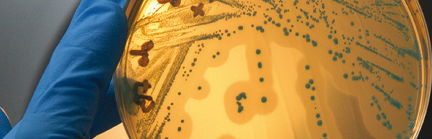 Corso ECM / Il challenge test: strumento operativo per valutare Listeria monocytogenes alla luce del Reg. CE 2073/2005