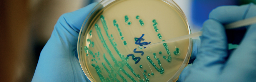 Corso / Il challenge test: strumento operativo per valutare Listeria monocytogenes alla luce del Reg. CE 2073/2005