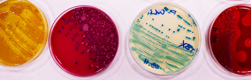 SCS1 - Microbiologia generale e sperimentale