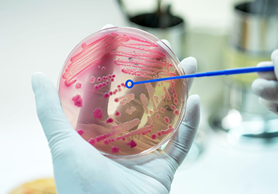 Escherichia coli isolato in laboratorio