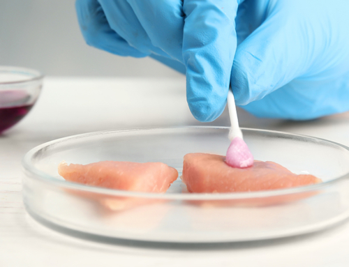 Aumento dei casi gravi di infezione da listeria in Europa, secondo l’ultimo rapporto annuale dell’UE