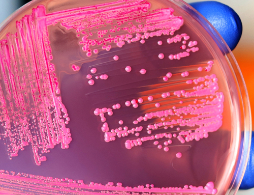 Corso ECM webinar / I challenge test e le nuove sfide per garantire la sicurezza microbiologica degli alimenti